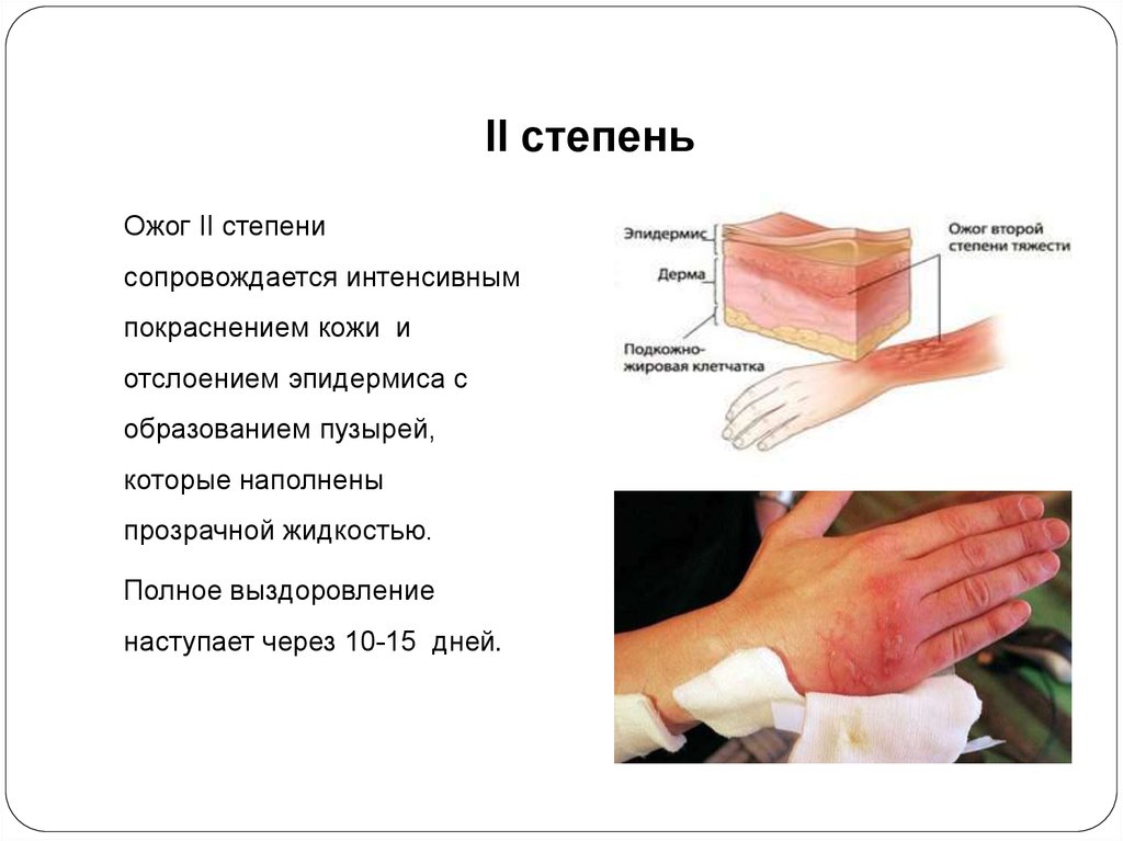 Побледнение кожных покровов свидетельствует