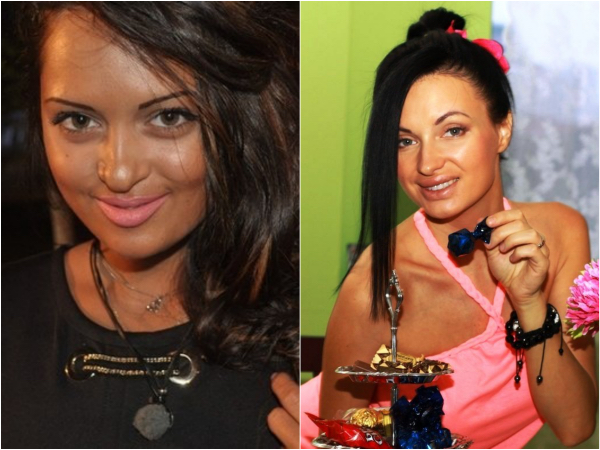 Оксана самойлова до и после пластики