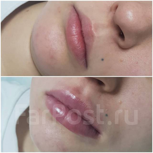 Как увеличить губы в домашних условиях с помощью упражнений?