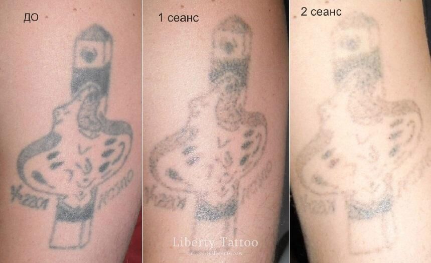 13 советов по безопасности при татуировке, о которых следует помнить при нанесении татуировки — все о тату