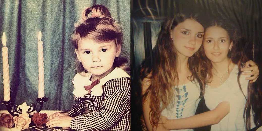 Misha romanova before and after plastic surgery. photo