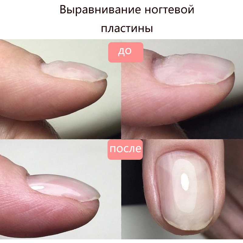 Как снять акриловые ногти в домашних условиях: как снять акрил правильно