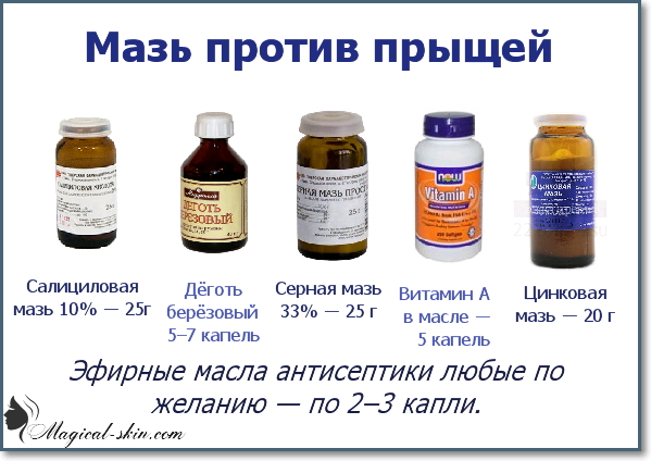 Лечение постакне в домашних условиях: кремы, народные средства и маски - как фея