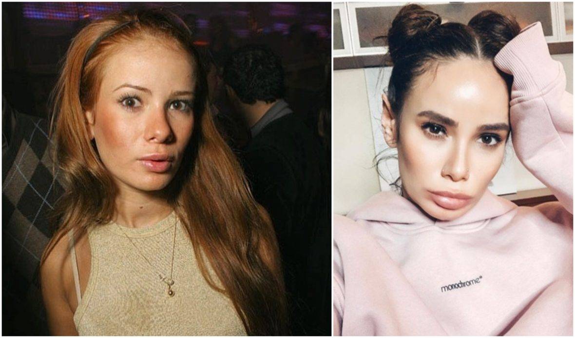 Айза долматова: фото до и после операции. айза анохина: новая жизнь “ice baby” айза до и после